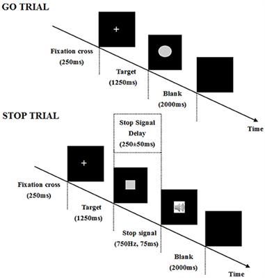 Response Inhibition Deficits in Insomnia Disorder: An Event-Related Potential Study With the Stop-Signal Task